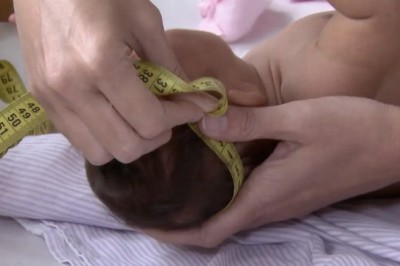 Governo Federal garante R$ 60 mil para pessoa com síndrome congênita causada pelo vírus Zika durante gestação